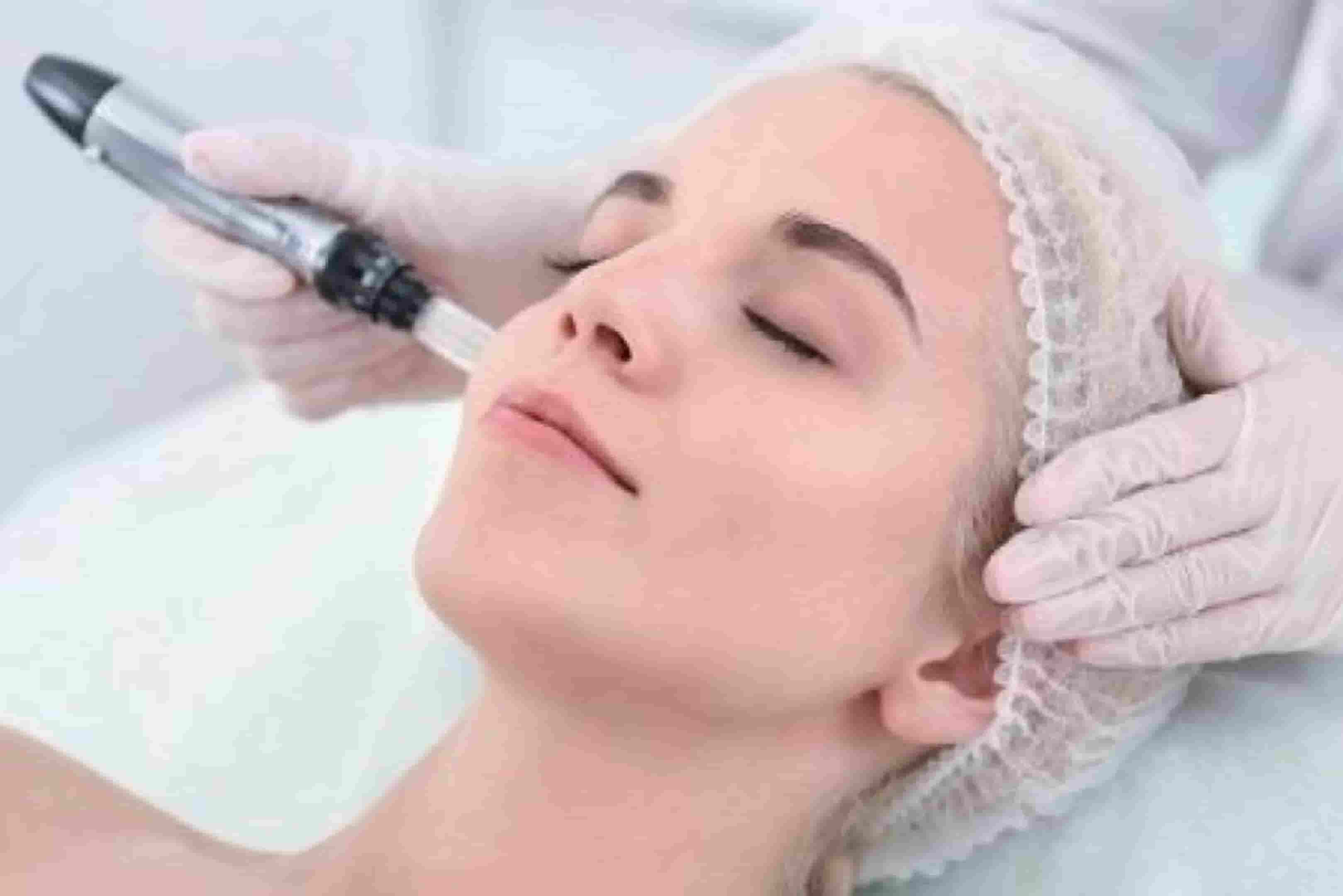 Dilluminaskin-microneedling-blog-benefits